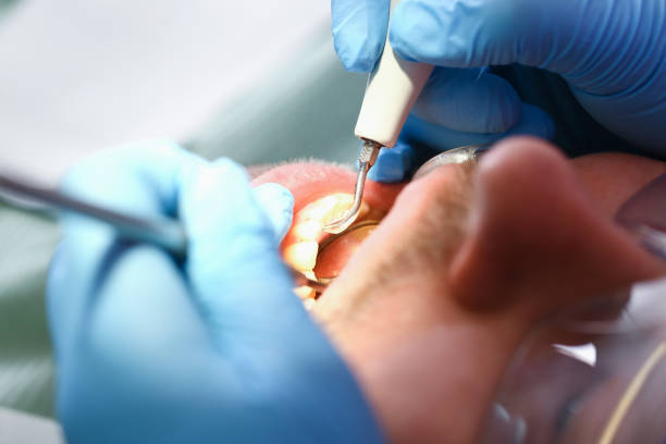 Best Emergency Tooth Extraction  in Alexandria, LA