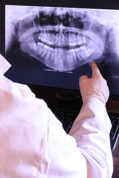 Best Broken Tooth Emergency  in Alexandria, LA