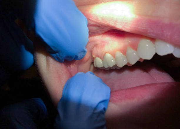 Best Cracked Tooth Emergency Dentist  in Alexandria, LA
