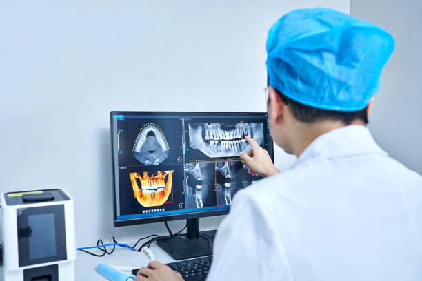Best Teeth Whitening  in Alexandria, LA